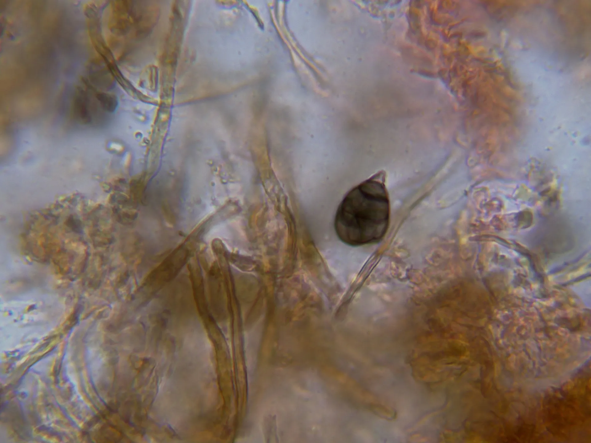 Microscopía de Oncopodiella trigonella - 10 - Conidios-004